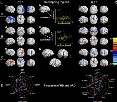 Distinct Features of Cerebral Blood Flow and Spontaneous Neural Activity as Integrated Predictors of Early Response to Antidepressants